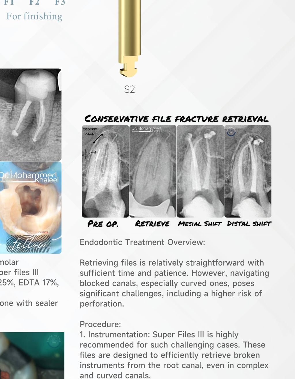 Canal Pro System – detail 4